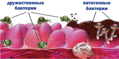 пробиотики